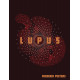 LUPUS TP 